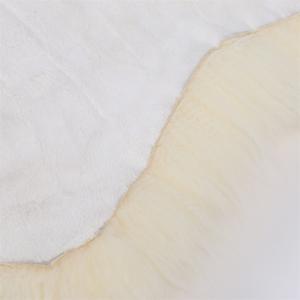 Skin type